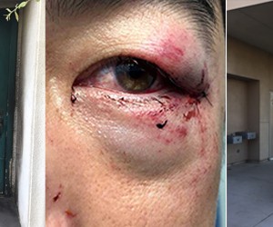 Churches, priest victimized in summer attacks